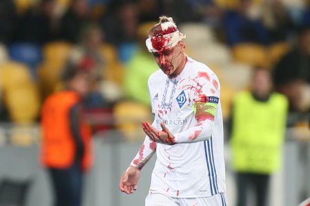 Domagoj Vida got 10 stitches, but no concussion